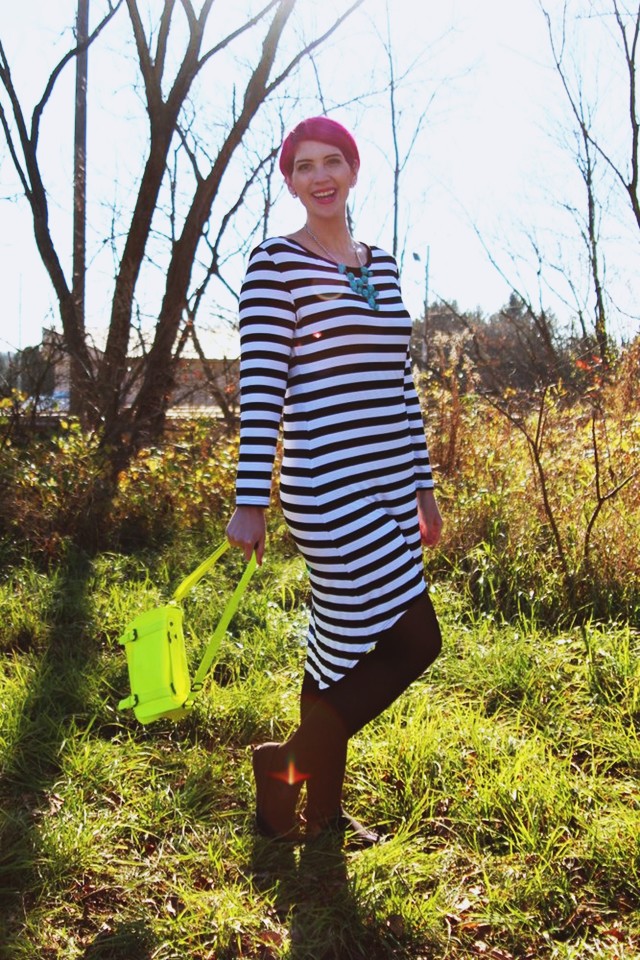 striped-dress-photography-01