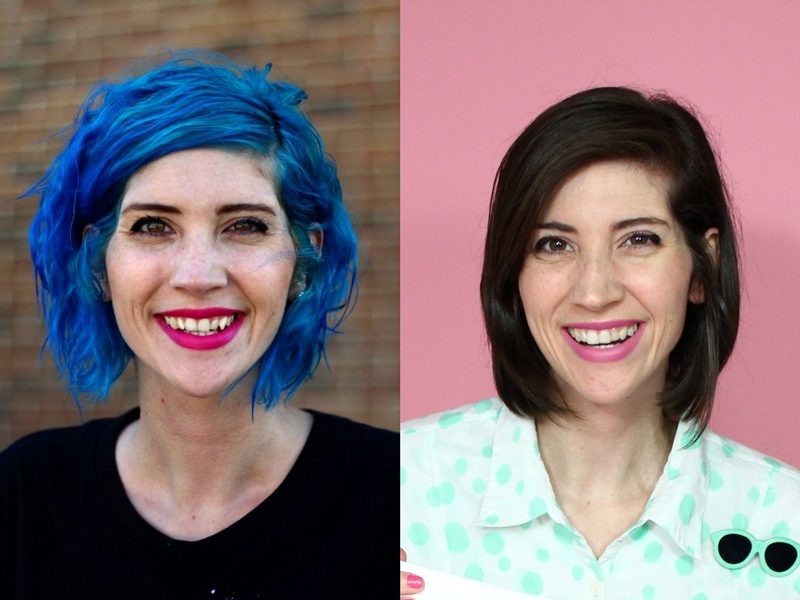 Hannah Rupp The Outfit Repeater Smile Direct Club treatment invisible aligners